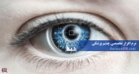 نرم افزار تخصصی چشم پزشکی(برنامه تخصصی چشم پزشکی)